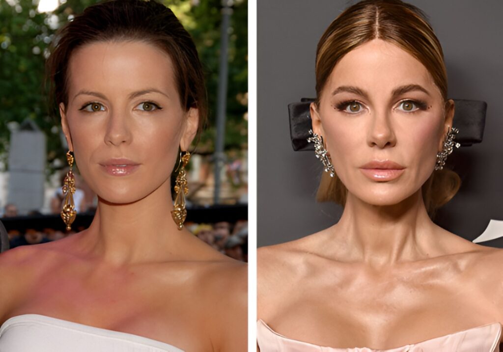15 Plastic Surgeries That Completely Changed a Celebrity’s Face