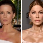 15 Plastic Surgeries That Completely Changed A Celebrity’s Face 32 15 Plastic Surgeries That Completely Changed a Celebrity’s Face