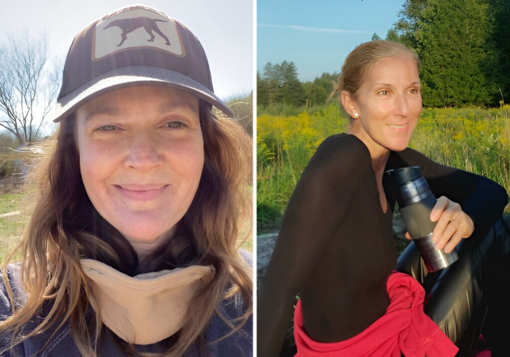 20 Stunning Celebrities Who Proudly Embrace Their Natural Beauty