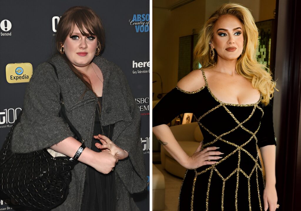 25 Shocking Celebrity Face Transformations You Won’t Believe