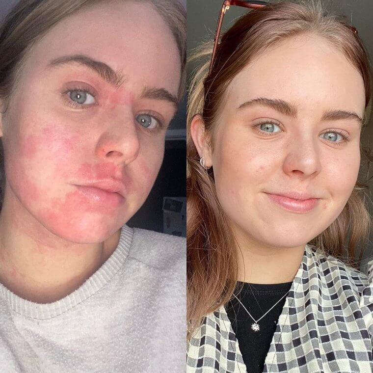 Simple Vaseline Hacks To Level Up Your Beauty Routine 16 Simple Vaseline Hacks to Level Up Your Beauty Routine