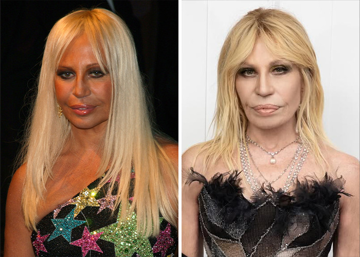 25 Shocking Celebrity Face Transformations You Won’t Believe 5 25 Shocking Celebrity Face Transformations You Won’t Believe