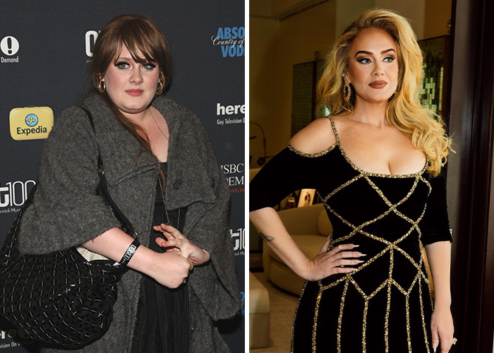 25 Shocking Celebrity Face Transformations You Won’t Believe 6 25 Shocking Celebrity Face Transformations You Won’t Believe