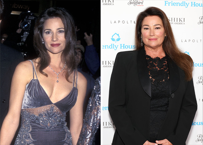 25 Shocking Celebrity Face Transformations You Won’t Believe 10 25 Shocking Celebrity Face Transformations You Won’t Believe