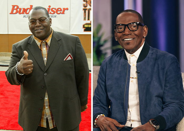 25 Shocking Celebrity Face Transformations You Won’t Believe 11 25 Shocking Celebrity Face Transformations You Won’t Believe