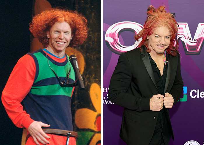 25 Shocking Celebrity Face Transformations You Won’t Believe 14 25 Shocking Celebrity Face Transformations You Won’t Believe