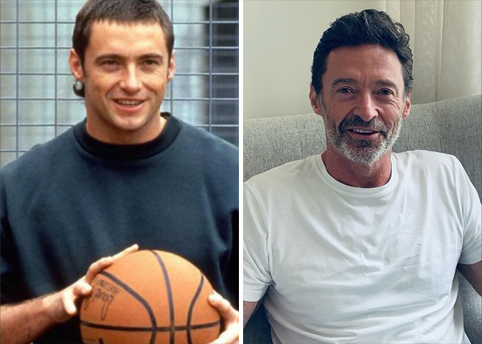 25 Shocking Celebrity Face Transformations You Won’t Believe 15 25 Shocking Celebrity Face Transformations You Won’t Believe