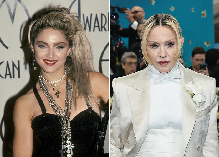 25 Shocking Celebrity Face Transformations You Won’t Believe 16 25 Shocking Celebrity Face Transformations You Won’t Believe