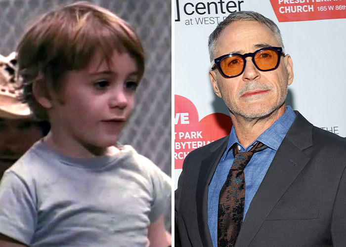 25 Shocking Celebrity Face Transformations You Won’t Believe 17 25 Shocking Celebrity Face Transformations You Won’t Believe