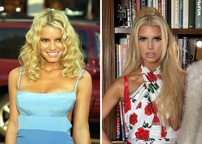 25 Shocking Celebrity Face Transformations You Won’t Believe 19 25 Shocking Celebrity Face Transformations You Won’t Believe