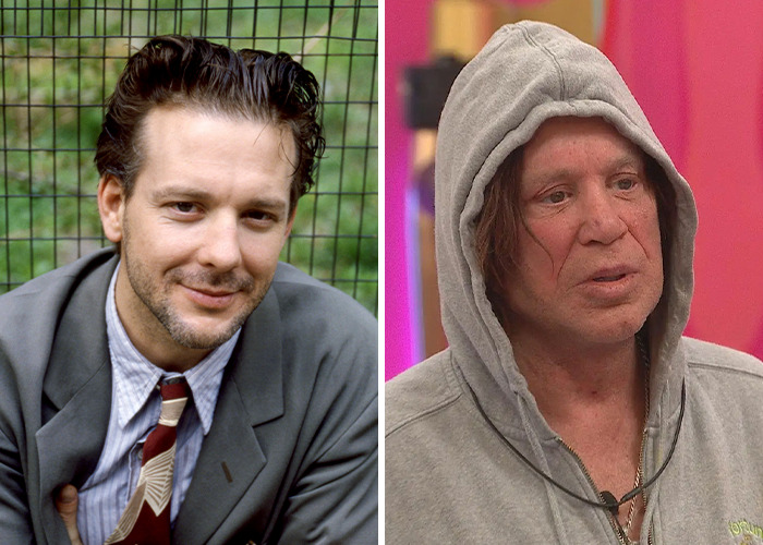 25 Shocking Celebrity Face Transformations You Won’t Believe 21 25 Shocking Celebrity Face Transformations You Won’t Believe