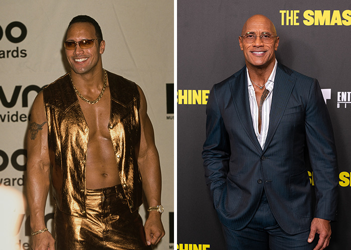 25 Shocking Celebrity Face Transformations You Won’t Believe 24 25 Shocking Celebrity Face Transformations You Won’t Believe