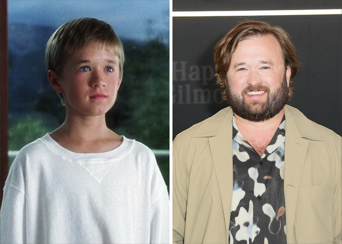 25 Shocking Celebrity Face Transformations You Won’t Believe 25 25 Shocking Celebrity Face Transformations You Won’t Believe