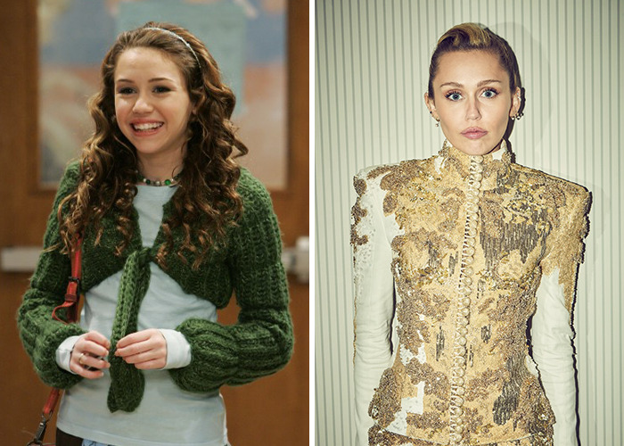 25 Shocking Celebrity Face Transformations You Won’t Believe 26 25 Shocking Celebrity Face Transformations You Won’t Believe