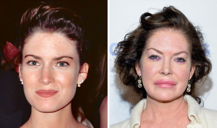 15 Plastic Surgeries That Completely Changed a Celebrity’s Face