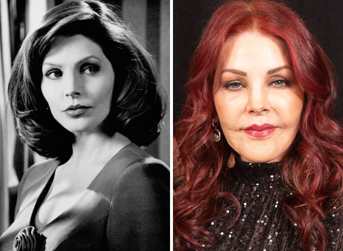 15 Plastic Surgeries That Completely Changed a Celebrity’s Face