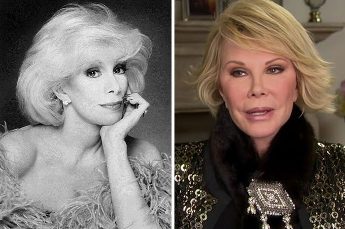 15 Plastic Surgeries That Completely Changed a Celebrity’s Face