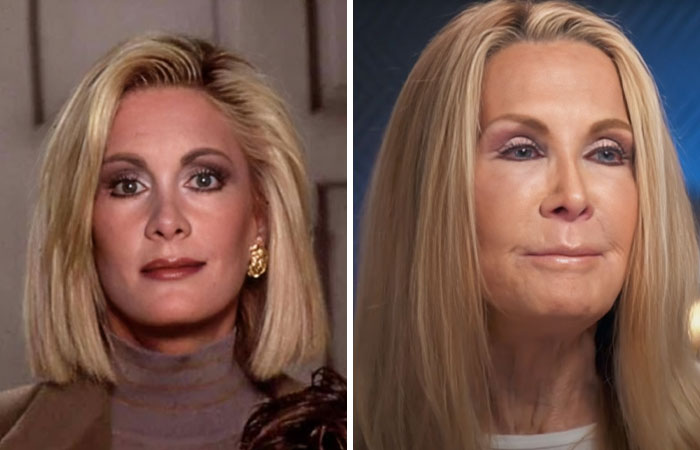 15 Plastic Surgeries That Completely Changed a Celebrity’s Face