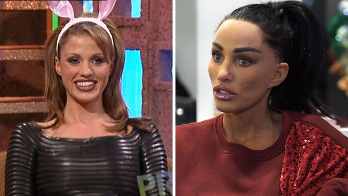 15 Plastic Surgeries That Completely Changed a Celebrity’s Face