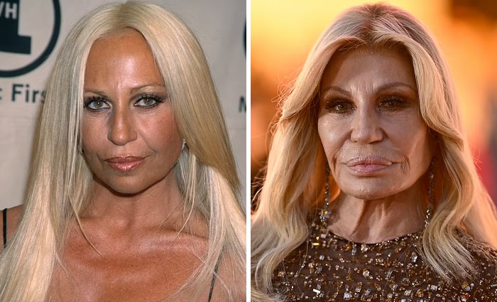 15 Plastic Surgeries That Completely Changed a Celebrity’s Face