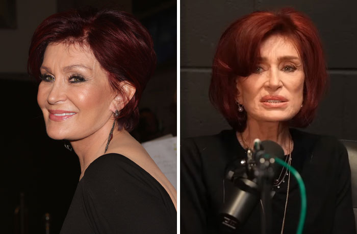 15 Plastic Surgeries That Completely Changed a Celebrity’s Face