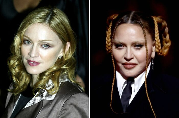 15 Plastic Surgeries That Completely Changed a Celebrity’s Face