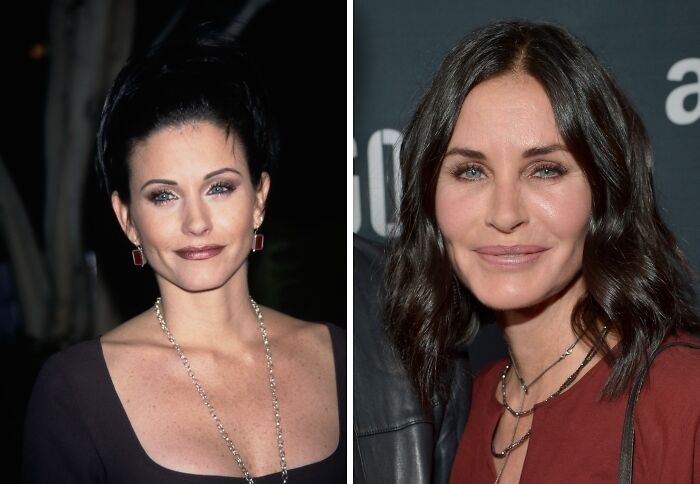 15 Plastic Surgeries That Completely Changed a Celebrity’s Face