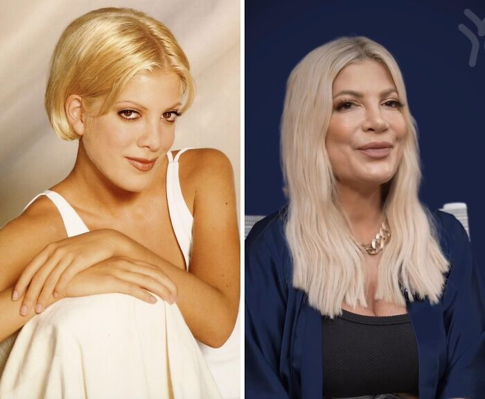 15 Plastic Surgeries That Completely Changed a Celebrity’s Face