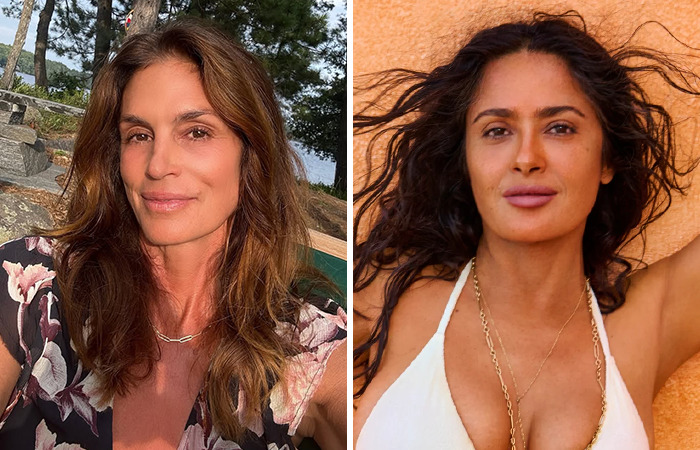 20 Celeb Comparison Photos: Plastic Surgery Vs. Aging Naturally 17 20 Celeb Comparison Photos: Plastic Surgery vs. Aging Naturally