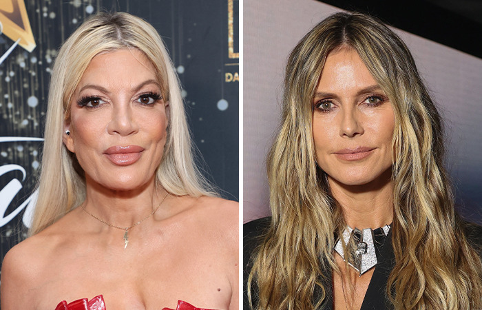 20 Celeb Comparison Photos: Plastic Surgery Vs. Aging Naturally 20 20 Celeb Comparison Photos: Plastic Surgery vs. Aging Naturally