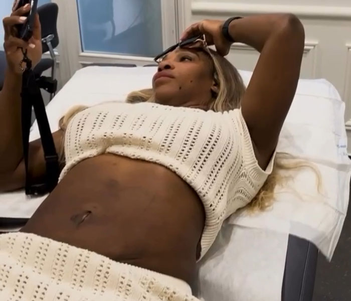 15 Unfiltered Celebrity Photos That Show Them Keeping It Real