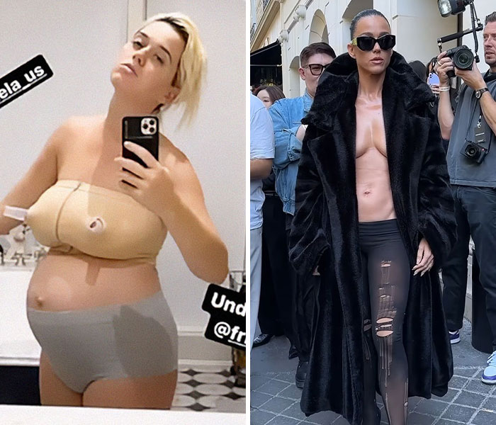 15 Unfiltered Celebrity Photos That Show Them Keeping It Real