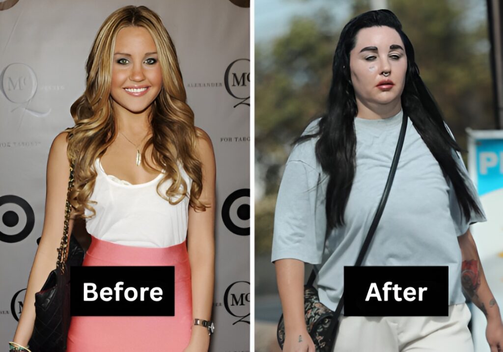15 Celebrity Transformations That Shocked Everyone This Year