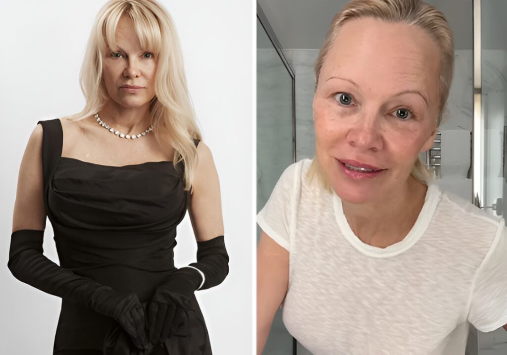 15 Unfiltered Celebrity Photos That Show Them Keeping It Real