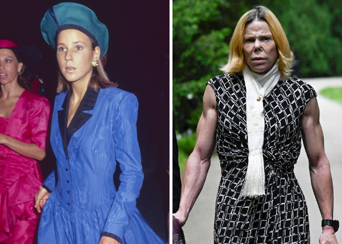 15 Celebrity Transformations That Shocked Everyone This Year 3 15 Celebrity Transformations That Shocked Everyone This Year